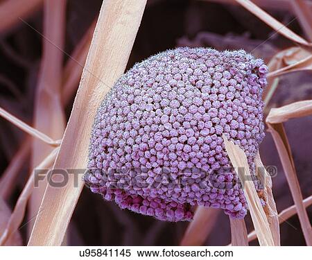Stock Illustration - Fungal cells, SEM. Fotosearch