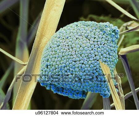 Stock Illustration - Fungal cells, SEM. Fotosearch
