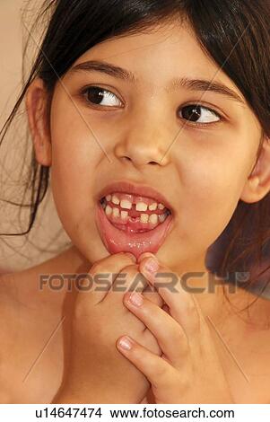Picture - girl with missing tooth. Fotosearch