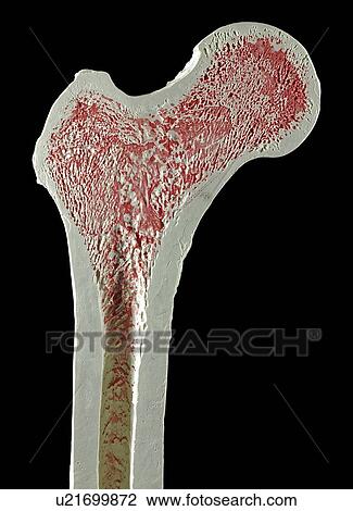 Drawing - Upper right femur (leg bone). Fotosearch