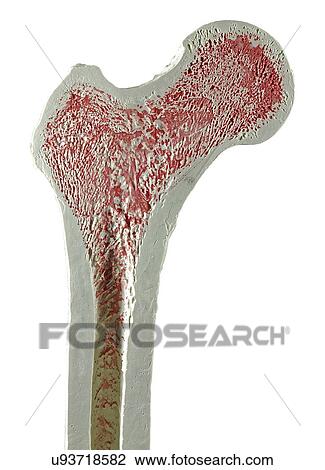 Upper right femur (leg bone) View Large Illustration Drawing - Upper right femur (leg bone). Fotosearch