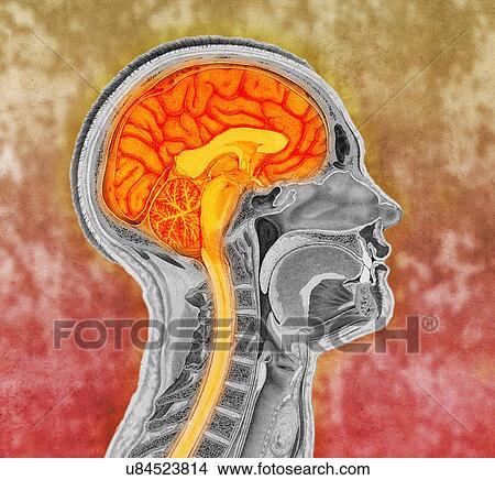 Colorized antique illustration of the human brain View Large Photo Image Picture - Colorized antique illustration of the human brain. Fotosearch