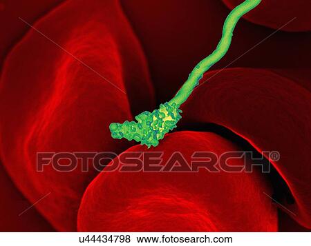 Colorized SEM of a spiral-shaped Borrelia hermsii bacterium (green) on a number of red-colored red blood cells. B. hermsii is the causative agent of tick-borne relapsing fever (TBRF) View Large Photo Image Stock Photo - Colorized SEM of a spiral-shaped Borrelia hermsii bacterium (green) on a number of red-colored red blood cells. B. hermsii is the causative agent of tick-borne relapsing fever (TBRF). Fotosearch