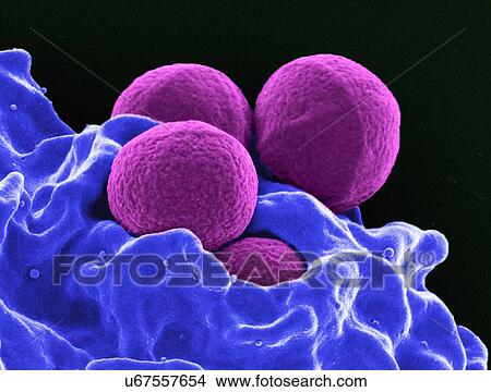 Colorized SEM of four spherical methicillin-resistant Staphylococcus aureus (MRSA) bacteria (purple) in the process of being phagocytized by a human neutrophil white blood cell (blue) View Large Photo Image Picture - Colorized SEM of four spherical methicillin-resistant Staphylococcus aureus (MRSA) bacteria (purple) in the process of being phagocytized by a human neutrophil white blood cell (blue). Fotosearch