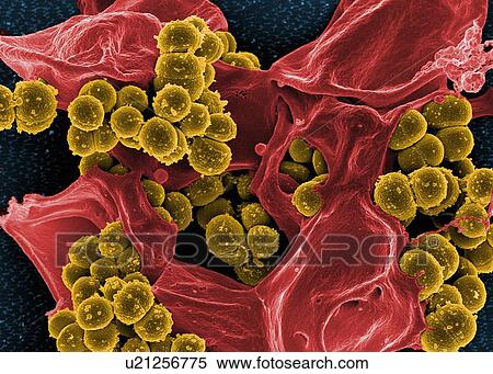 Stock Photography - Colorized SEM of methicillin-resistant Staphylococcus aureus (MRSA) bacteria in the process of being phagocytized by a human neutrophil white blood cell. Fotosearch