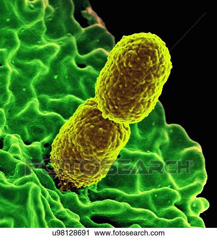 Stock Image - Colorized SEM of two rod-shaped carbapenem-resistant Klebsiella pneumoniae (CRKP) bacteria (yellow) interacting with a human neutrophil white blood cell (green). Fotosearch