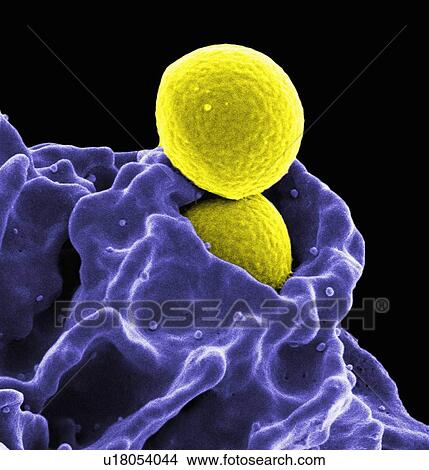 Picture - Colorized SEM of two spherical methicillin-resistant Staphylococcus aureus (MRSA) bacteria (yellow) in the process of being phagocytized by a human neutrophil white blood cell (blue). Fotosearch