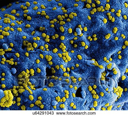 Colorized SEM showing numerous Middle East respiratory syndrome Coronavirus (MERS-CoV) viral particles (yellow) on the surface of a Vero E6 cell (blue) View Large Photo Image Stock Image - Colorized SEM showing numerous Middle East respiratory syndrome Coronavirus (MERS-CoV) viral particles (yellow) on the surface of a Vero E6 cell (blue). Fotosearch