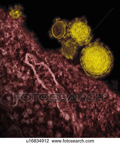 Stock Image - "Colorized transmission electron micrograph (TEM) showing five spherical-shaped Middle East Respiratory Syndrome Coronavirus (MERS-CoV) virions, colorized yellow". Fotosearch