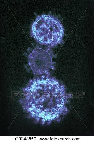 Stock Image - Colorized transmission electron micrograph (TEM) showing three spherical-shaped Middle East Respiratory Syndrome Coronavirus (MERS-CoV) virions. Fotosearch