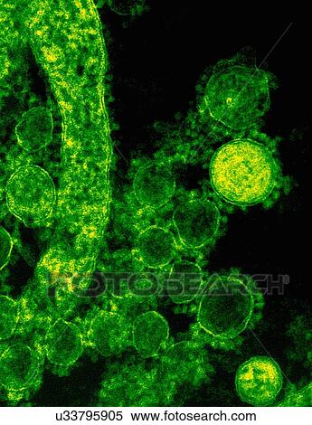 Colorized transmission electron micrograph (TEM) showing spherical-shaped Middle East Respiratory Syndrome Coronavirus (MERS-CoV) virions View Large Photo Image Stock Photography - Colorized transmission electron micrograph (TEM) showing spherical-shaped Middle East Respiratory Syndrome Coronavirus (MERS-CoV) virions. Fotosearch