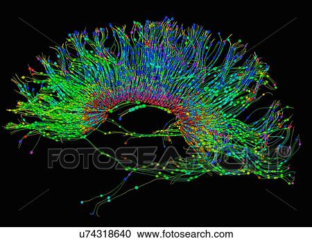 "Diffusion MRI, also referred to as diffusion tensor imaging or DTI, of the human brain" View Large Photo Image Stock Image - "Diffusion MRI, also referred to as diffusion tensor imaging or DTI, of the human brain". Fotosearch