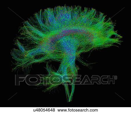 Stock Photo - "Diffusion MRI, also referred to as diffusion tensor imaging or DTI, of the human brain". Fotosearch