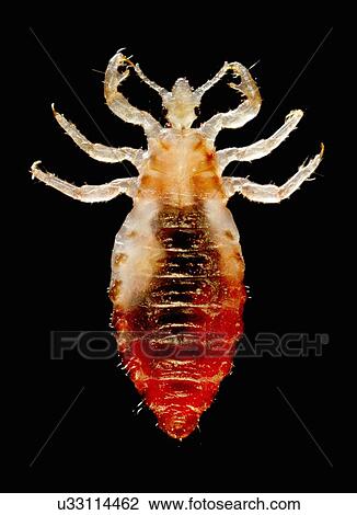 Stock Image - "Dorsal view of a male body louse, Pediculus humanus var. corporis. Sensorial setae, (hairs) cover the louse's body. The dark mass inside the abdomen is a previously ingested blood meal". Fotosearch