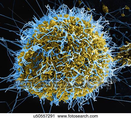 Stock Image - Filamentous Ebola virus particles (colored blue) budding from a chronically-infected VERO E6 cell (colored yellow). Fotosearch