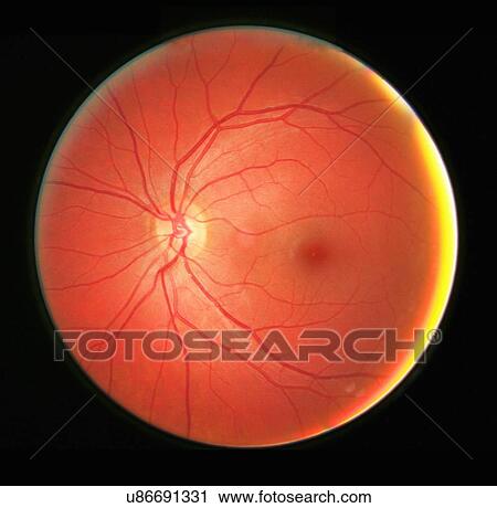 Stock Image - "Fundus photograph of the left eye, showing the retina, macula, fovea and related structures". Fotosearch