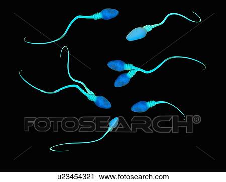 Stock Image - Illustration of abnormalities and deformities of human sperm cells. Fotosearch