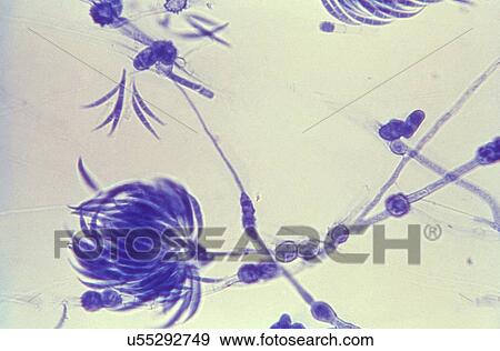 Lactophenol cotton blue-stained Fusarium fungal organism View Large Photo Image Stock Photo - Lactophenol cotton blue-stained Fusarium fungal organism. Fotosearch