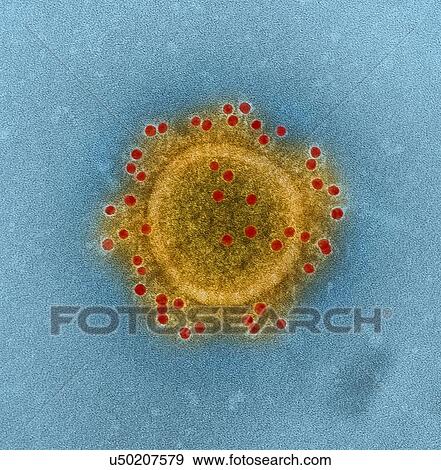 Middle East Respiratory Syndrome Coronavirus particle envelope proteins immunolabeled with Rabbit HCoV-EMC/2012 primary antibody and Goat anti-Rabbit 10 nm gold particles View Large Photo Image Stock Photo - Middle East Respiratory Syndrome Coronavirus particle envelope proteins immunolabeled with Rabbit HCoV-EMC/2012 primary antibody and Goat anti-Rabbit 10 nm gold particles. Fotosearch