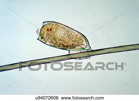 Stock Photo - "Nymph of head louse, Pediculus humanus var. capitis, about to emerge from egg. Missing egg cap". Fotosearch