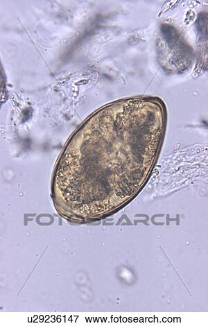 "Photomicrograph of an unstained formalin-preserved stool specimen mount, magnified 500X, showing a Paragonimus westermani termatode egg" View Large Photo Image Stock Photo - "Photomicrograph of an unstained formalin-preserved stool specimen mount, magnified 500X, showing a Paragonimus westermani termatode egg". Fotosearch