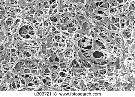 Stock Photo - "Scanning electron micrograph of Gram negative, anaerobic, Borrelia burgdorferi bacteria, which had been derived from a pure culture. This pathogenic organism is responsible for causing Lyme disease". Fotosearch