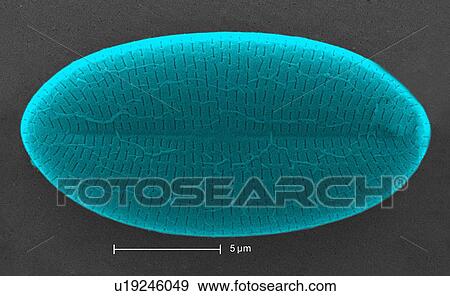 Stock Photo - Scanning electron micrograph showing a diatom found in an untreated water specimen extracted from a wild stream. Magnification 6500x. Fotosearch