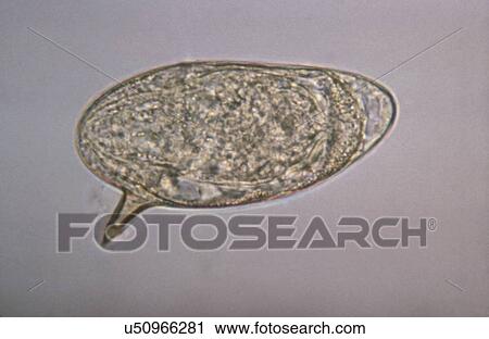 Stock Image - "Schistosoma mansoni egg showing lateral spine. Schistosomiasis (also known as bilharzia, snail fever, and Katayama fever) is a disease caused by parasitic worms of the Schistosoma type". Fotosearch