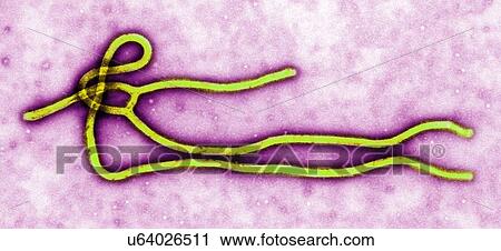 Transmission electron micrograph (TEM) of an Ebola virus virion View Large Photo Image Stock Image - Transmission electron micrograph (TEM) of an Ebola virus virion. Fotosearch