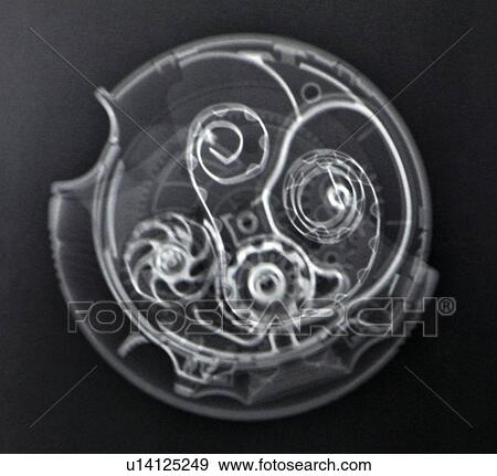 Stock Photo - X-ray of an Advair diskus asthma inhaler. Fotosearch