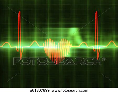 Stock Illustration - Computer artwork of a heart-shaped electrocardiogram (ECG) trace. An ECG measures the electrical activity of the heart.. Fotosearch