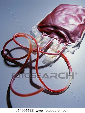 Stock Image - Bag containing a donation of blood for use in transfusions. Fotosearch