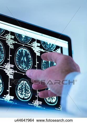 Picture - Doctor viewing a series of MRI (Magnetic Resonance Imaging) brain scans on a screen. Fotosearch