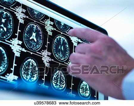 Stock Image - Doctor viewing a series of MRI (Magnetic Resonance Imaging) brain scans on a screen. Fotosearch