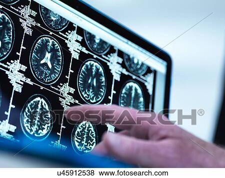 Doctor viewing a series of MRI (Magnetic Resonance Imaging) brain scans on a screen View Large Photo Image Stock Photo - Doctor viewing a series of MRI (Magnetic Resonance Imaging) brain scans on a screen. Fotosearch