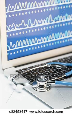 Stock Photo - Medical genetics. Acoustic stethoscope on a laptop computer, that displays results of automated DNA sequencing. Fotosearch