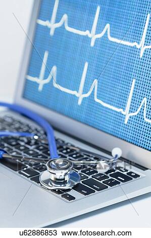 Stock Image - Modern cardiology. Acoustic stethoscope on a laptop computer that displays an EKG trace. Fotosearch