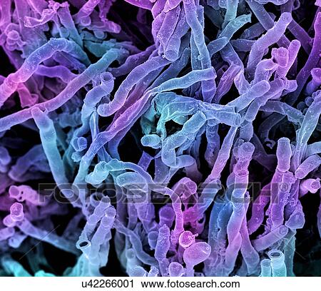 Clip Art - Actinomyces viscosus bacteria. Coloured scanning electron micrograph (SEM) of strands of Actinomyces viscosus. Actinomyces viscosus is a filamentous soil bacterium, classified in the Actinobacteria.. Fotosearch