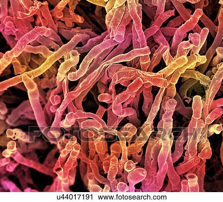 Clip Art - Actinomyces viscosus bacteria. Coloured scanning electron micrograph (SEM) of strands of Actinomyces viscosus. Actinomyces viscosus is a filamentous soil bacterium, classified in the Actinobacteria.. Fotosearch