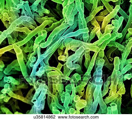 Actinomyces viscosus bacteria. Coloured scanning electron micrograph (SEM) of strands of Actinomyces viscosus. Actinomyces viscosus is a filamentous soil bacterium, classified in the Actinobacteria. View Large Illustration Drawing - Actinomyces viscosus bacteria. Coloured scanning electron micrograph (SEM) of strands of Actinomyces viscosus. Actinomyces viscosus is a filamentous soil bacterium, classified in the Actinobacteria.. Fotosearch