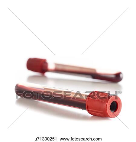 Blood collection tubes against a white background. View Large Illustration Clip Art - Blood collection tubes against a white background.. Fotosearch