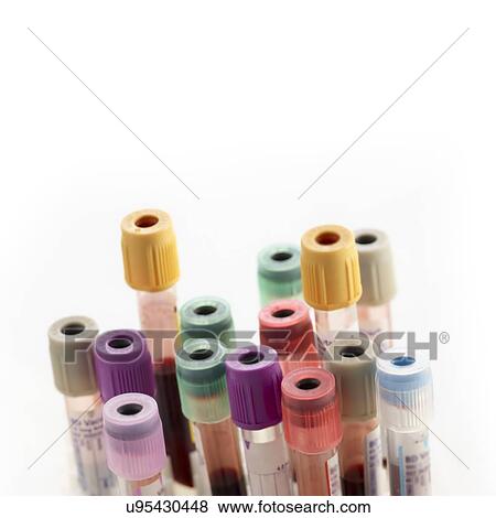 Blood collection tubes against a white background. View Large Illustration Stock Illustration - Blood collection tubes against a white background.. Fotosearch