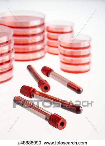 Blood collection tubes and petri dishes against a white background. View Large Illustration Clipart - Blood collection tubes and petri dishes against a white background.. Fotosearch