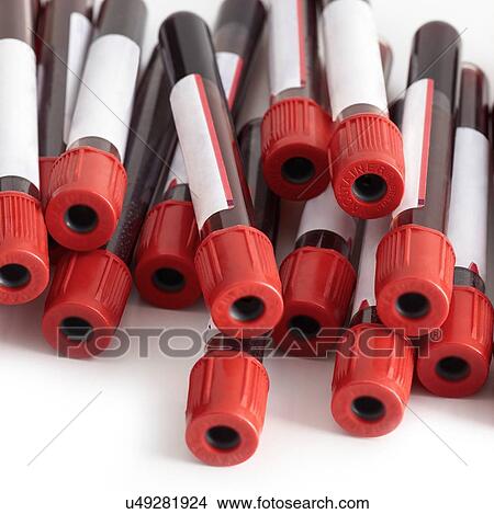 Blood collection tubes, close up. View Large Illustration Stock Illustration - Blood collection tubes, close up.. Fotosearch