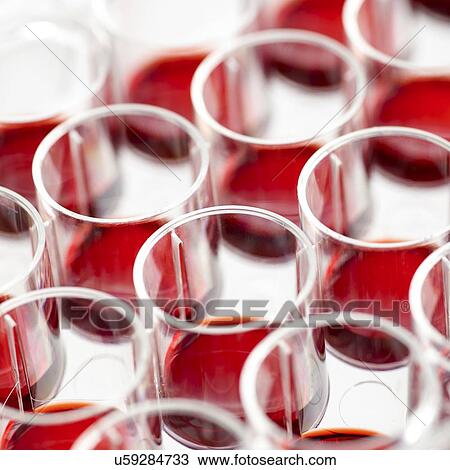 Blood samples in a multiwell tray. View Large Illustration Drawing - Blood samples in a multiwell tray.. Fotosearch