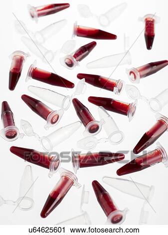 Blood samples in centrifuge tubes against a white background. View Large Illustration Clip Art - Blood samples in centrifuge tubes against a white background.. Fotosearch