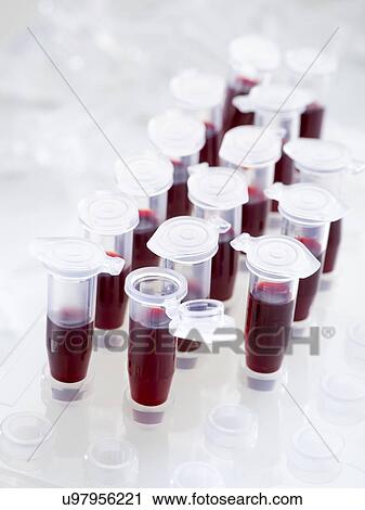Clip Art - Blood samples in centrifuge tubes.. Fotosearch