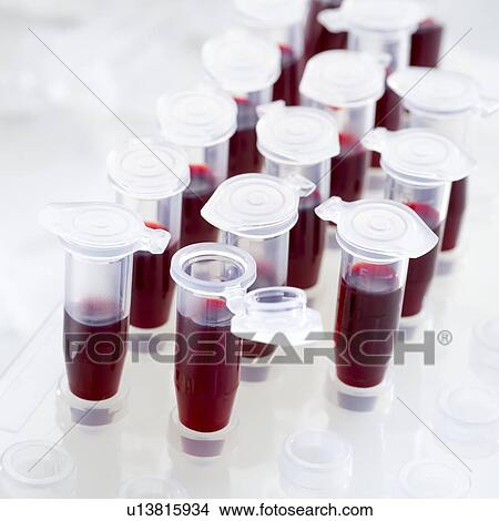 Blood samples in centrifuge tubes. View Large Illustration Stock Illustration - Blood samples in centrifuge tubes.. Fotosearch