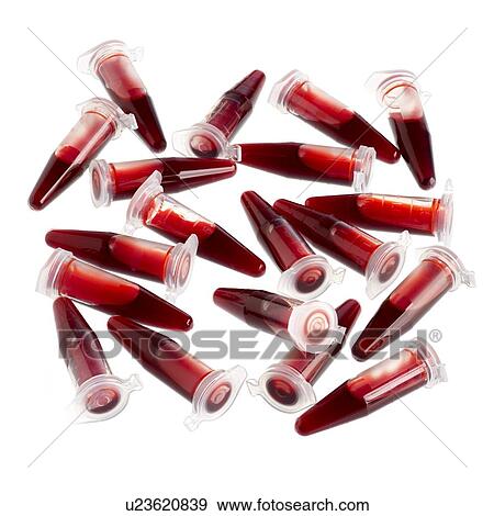 Blood samples in centrifuge tubes against a white background. View Large Illustration Stock Illustration - Blood samples in centrifuge tubes against a white background.. Fotosearch