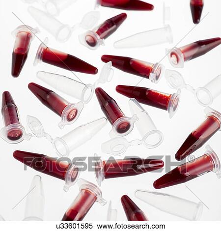 Blood samples in centrifuge tubes against a white background. View Large Illustration Stock Illustration - Blood samples in centrifuge tubes against a white background.. Fotosearch